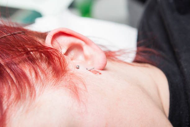 Young red-haired girl with piercing jewel just after to be pierced on ear skin. Tragus type